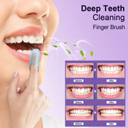 MySmile Deep Cleaning Teeth Wipes for Tooth Cleaner Teeth Wipes