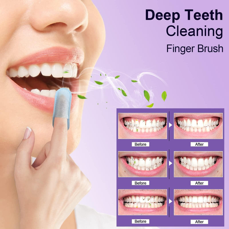 MySmile Deep Cleaning Teeth Wipes for Tooth Cleaner Teeth Wipes
