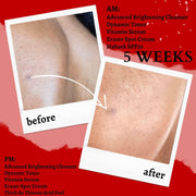 gymsegbë Thick As Thieves Pure Glycolic Acid Lactic Acid Extreme Gel Peel - 50ml Exfoliation, Dark Spots, Hyperpigmentation