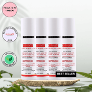 gymsegbë Thick As Thieves Pure Glycolic Acid Lactic Acid Extreme Gel Peel - 30ml Exfoliation, Dark Spots, Hyperpigmentation