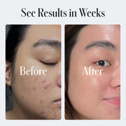 Geologie Clear System Starter Routine