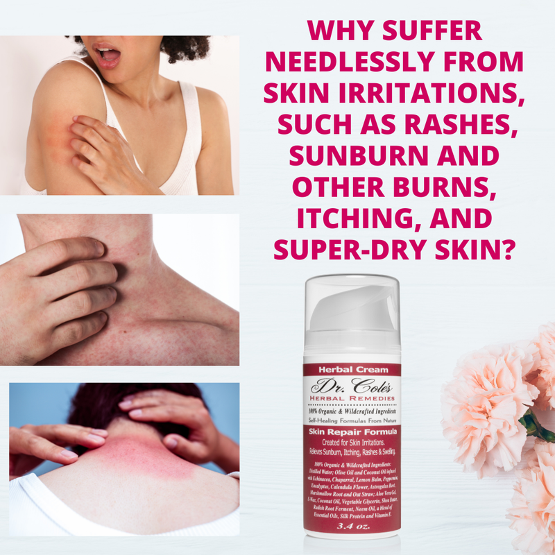 COLEHERBALS 17 - Dr. Cole's Organic Skin Repair Herbal Cream Herbal