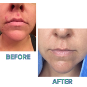 FATCO Skincare Products Cleansing Oil For Normal/Combo Skin 4 Oz