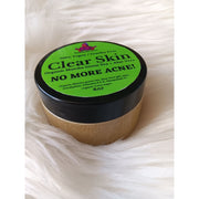 KaziRokz Organic Matcha Green Tea + Aloe Vera Acne Treatment/ Clear Skin Treatment (100% Vegan/CrueltyFree) 4oz