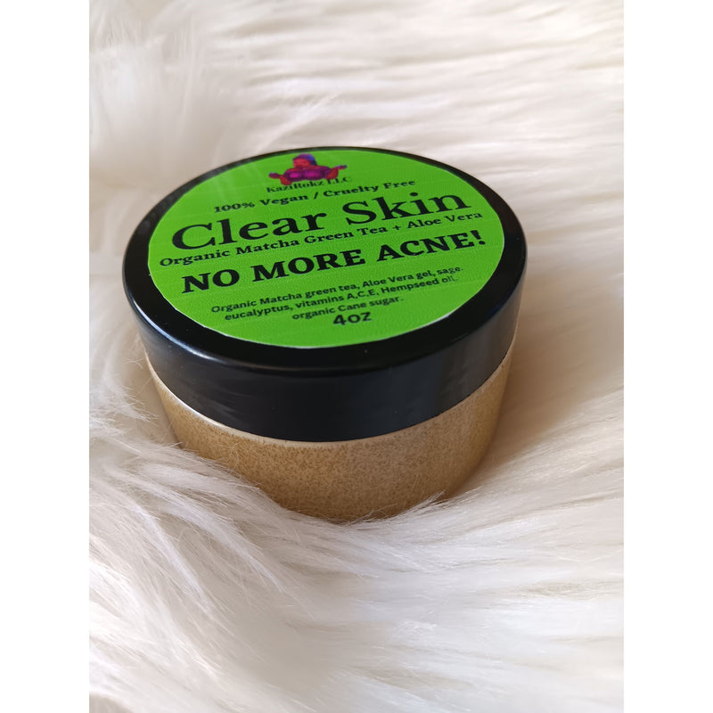 KaziRokz Organic Matcha Green Tea + Aloe Vera Acne Treatment/ Clear Skin Treatment (100% Vegan/CrueltyFree) 4oz
