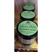 KaziRokz Organic Matcha Green Tea + Aloe Vera Acne Treatment/ Clear Skin Treatment (100% Vegan/CrueltyFree) 4oz