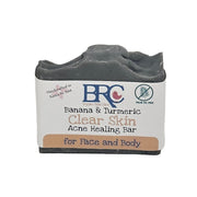 By Robin Creations Ultimate Clear Skin Acne Healing Facial Bundle w/Free Healing Cleansing Bar Acne Treatments & Kits