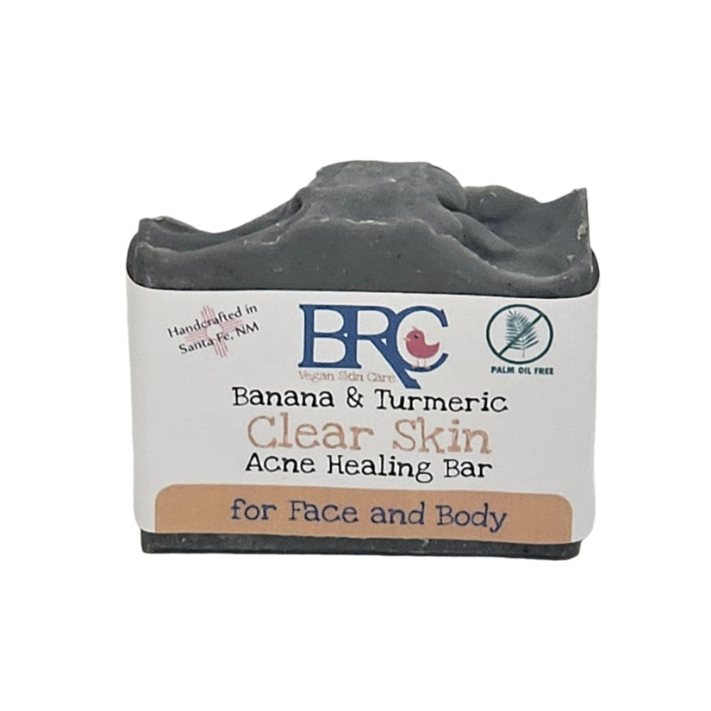 By Robin Creations Ultimate Clear Skin Acne Healing Facial Bundle w/Free Healing Cleansing Bar Acne Treatments & Kits