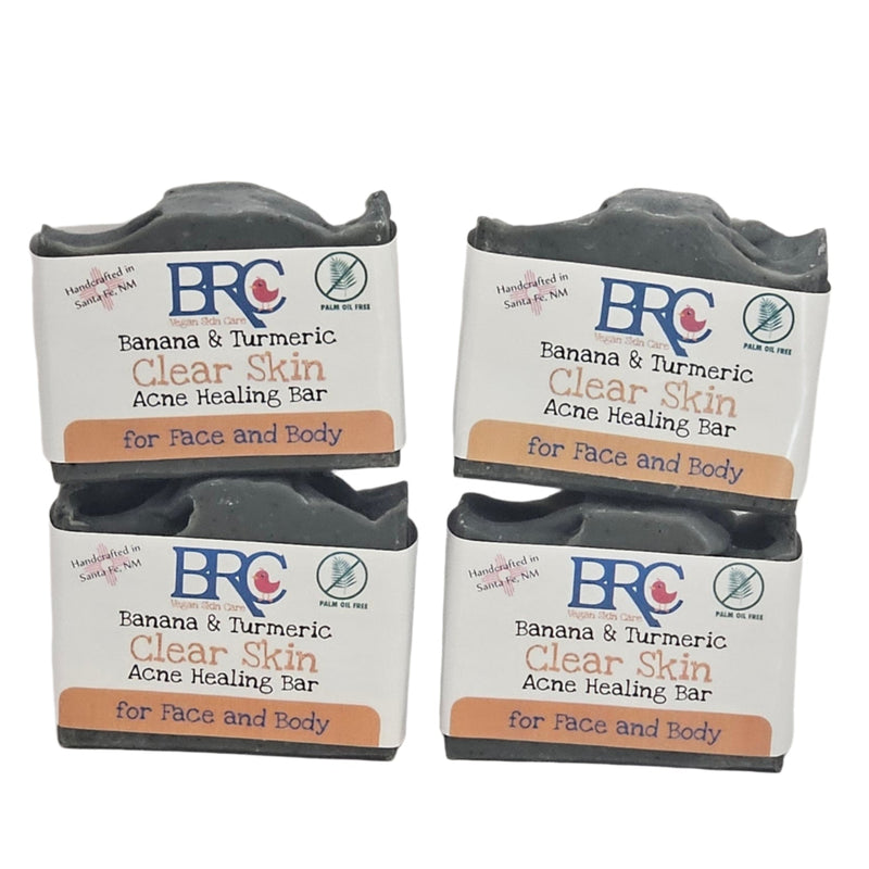 By Robin Creations Clear Skin Acne Blasting Face & Body Soap w/ Banana & Turmeric Acne Treatments & Kits