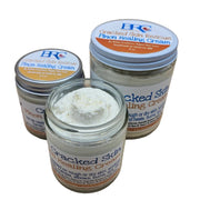 By Robin Creations Cracked Skin Rescue Pinon Healing/Eczema Cream Eczema Relief