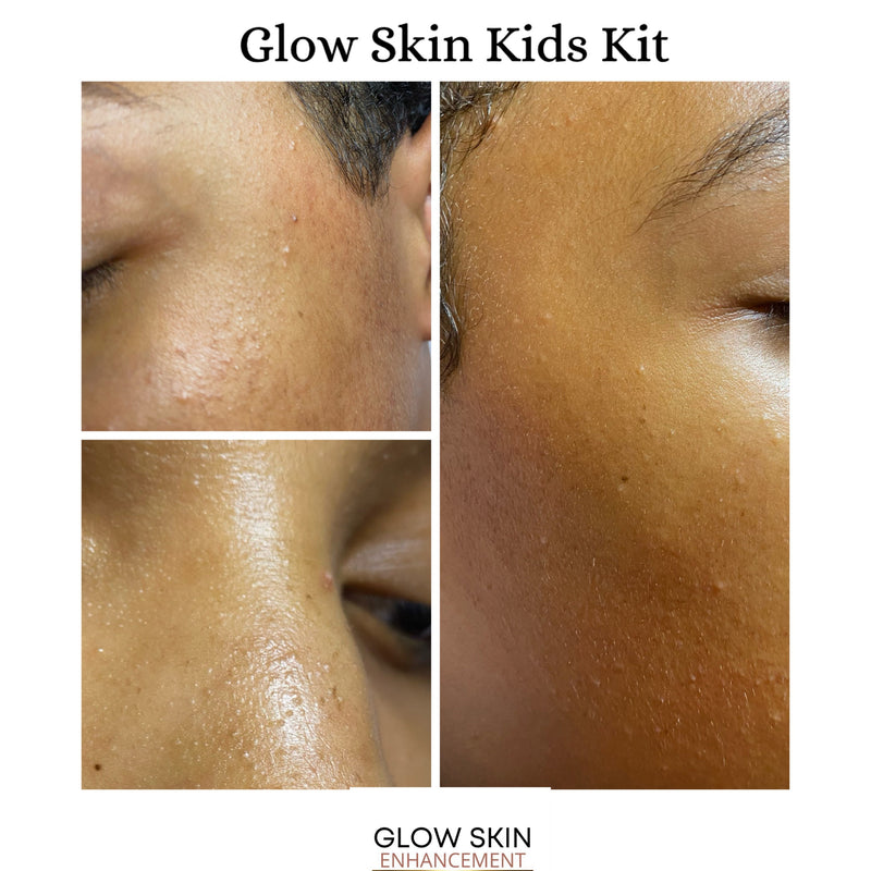 Glow Skin Enhancement GLOW SKIN KIDS KIT Kids Skincare Kit