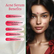 gymsegbë New Skin Natural Intensive Acne Serum Acne Treatments & Kits