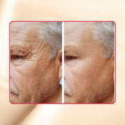 gymsegbë Thick As Thieves Pure Glycolic Acid Lactic Acid Extreme Gel Peel - 50ml Exfoliation, Dark Spots, Hyperpigmentation