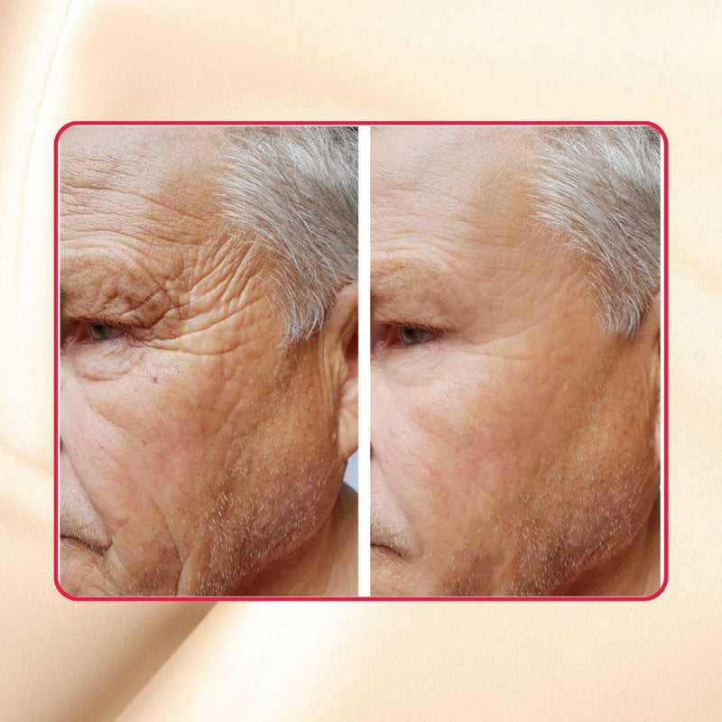 gymsegbë Thick As Thieves Pure Glycolic Acid Lactic Acid Extreme Gel Peel - 50ml Exfoliation, Dark Spots, Hyperpigmentation