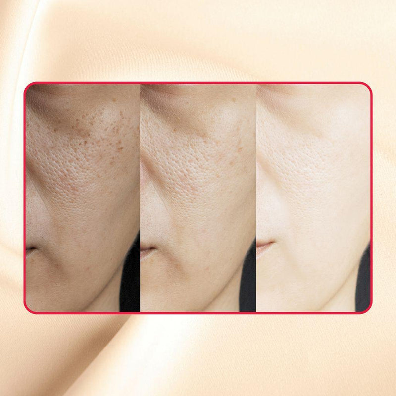 gymsegbë Thick As Thieves Pure Glycolic Acid Lactic Acid Extreme Gel Peel - 50ml Exfoliation, Dark Spots, Hyperpigmentation