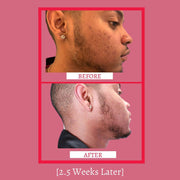 gymsegbë Mini Set - Travel Size - Glass Skin Set Sets