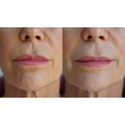 PRAI Beauty Ageless Lip & Line Filler Ageless Problem Solver