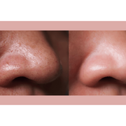 gymsegbë Ultra-Advanced Anti-Aging Daily Resurfacing Pads skincare