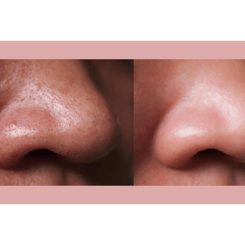 gymsegbë Ultra-Advanced Anti-Aging Daily Resurfacing Pads skincare