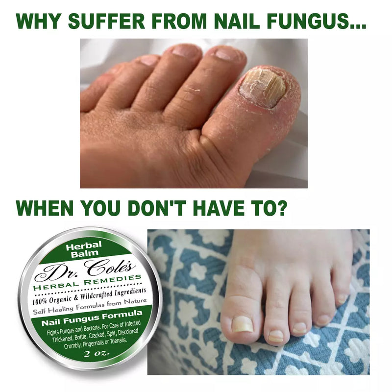 COLEHERBALS 12 - Dr. Cole's Nail Fungus Balm Herbal