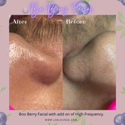 ZAQ Skin & Body ZAQ Nova Ultrasonic Skin Scrubber Spatula – 33,000 Hz Deep Cleansing Device