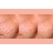 gymsegbë Ultra-Advanced Anti-Aging Daily Resurfacing Pads skincare