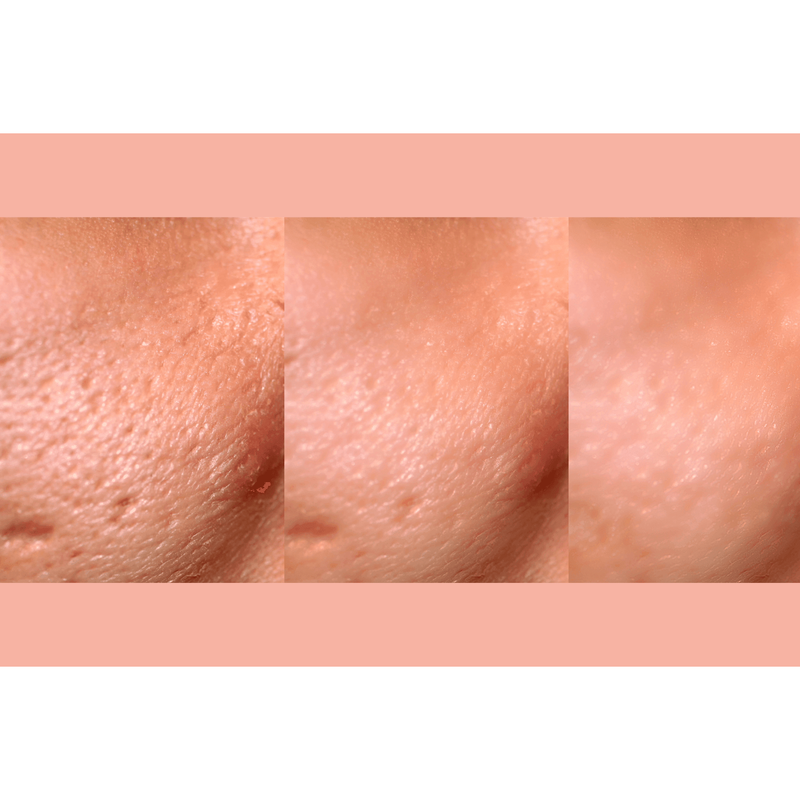 gymsegbë Ultra-Advanced Anti-Aging Daily Resurfacing Pads skincare