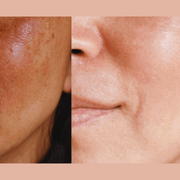 gymsegbë Ultra-Advanced Anti-Aging Daily Resurfacing Pads skincare