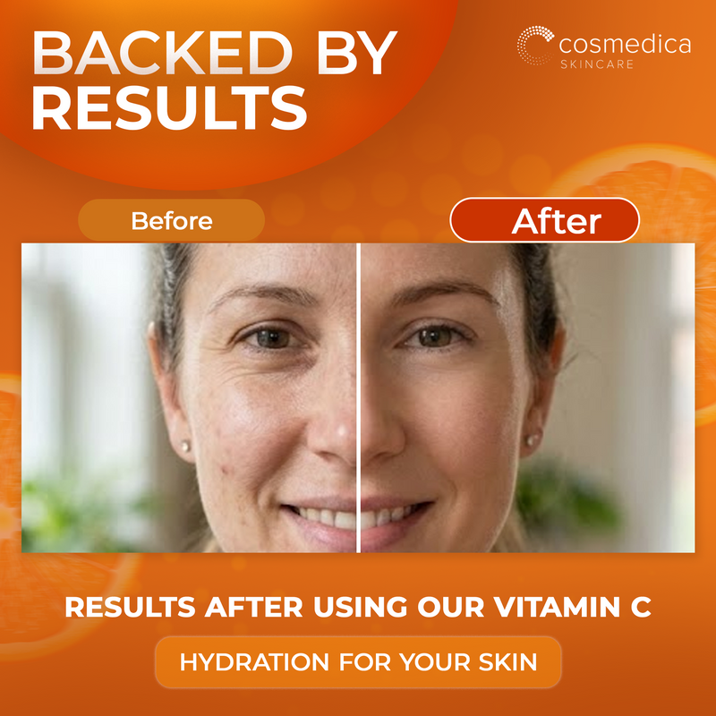 Cosmedica Skincare Cosmedica Skincare Vitamin C Serum for Face with Hyaluronic Acid – Anti Aging Serum for Dark Spots, Fine Lines, Wrinkles – Hydrating Collagen Booster for Women & Men Serum