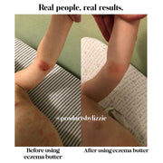 Lizzie's All-natural Products Lizzies All Natural Eczema Butter
