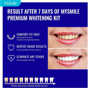 MySmile Prefilled Teeth Whitening Trays w/ 12% Hydrogen Peroxide Teeth Whitening
