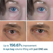 AsiaBeautyMall Dr. Melaxin Eyephalt Eyebag Cream Eye Cream