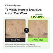 AsiaBeautyMall Abib Heartleaf TECA Capsule Serum Serum