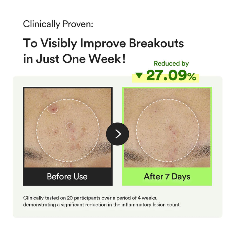 AsiaBeautyMall Abib Heartleaf TECA Capsule Serum Serum