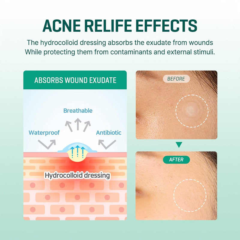AsiaBeautyMall SOME BY MI Clear Spot Patch Acne Treatment White Smoke