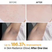 AsiaBeautyMall Dr. Melaxin Peel Shot Exfoliating Kojic Acid Turmeric Spray Exfoliator Gray
