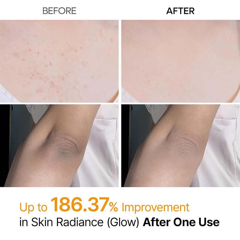 AsiaBeautyMall Dr. Melaxin Peel Shot Exfoliating Kojic Acid Turmeric Spray Exfoliator Gray