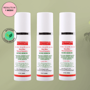 gymsegbë New Skin Natural Intensive Acne Serum Acne Treatments & Kits