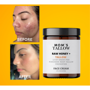 Mom’s Tallow Skin Serenity Face Cream – Nourishing Balm for Sensitive & Flaky Skin