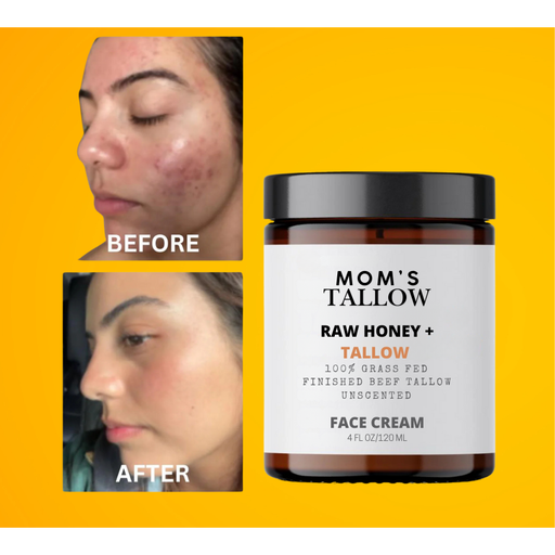 Mom’s Tallow Skin Serenity Face Cream – Nourishing Balm for Sensitive & Flaky Skin