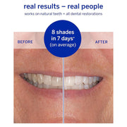 supersmile Supersmile Superstrips Teeth Whitening Dissolving Strips 14 Teeth Whitening