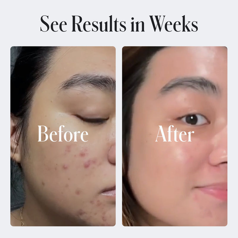 Geologie Clear Skin Face Cream