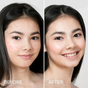 Maree Pimple & Acne Patches