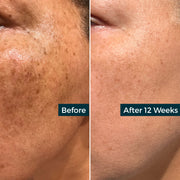 AbsoluteJOI® Skincare Retinol Plus Vitamin C Skin Refining Night Oil Face Oil