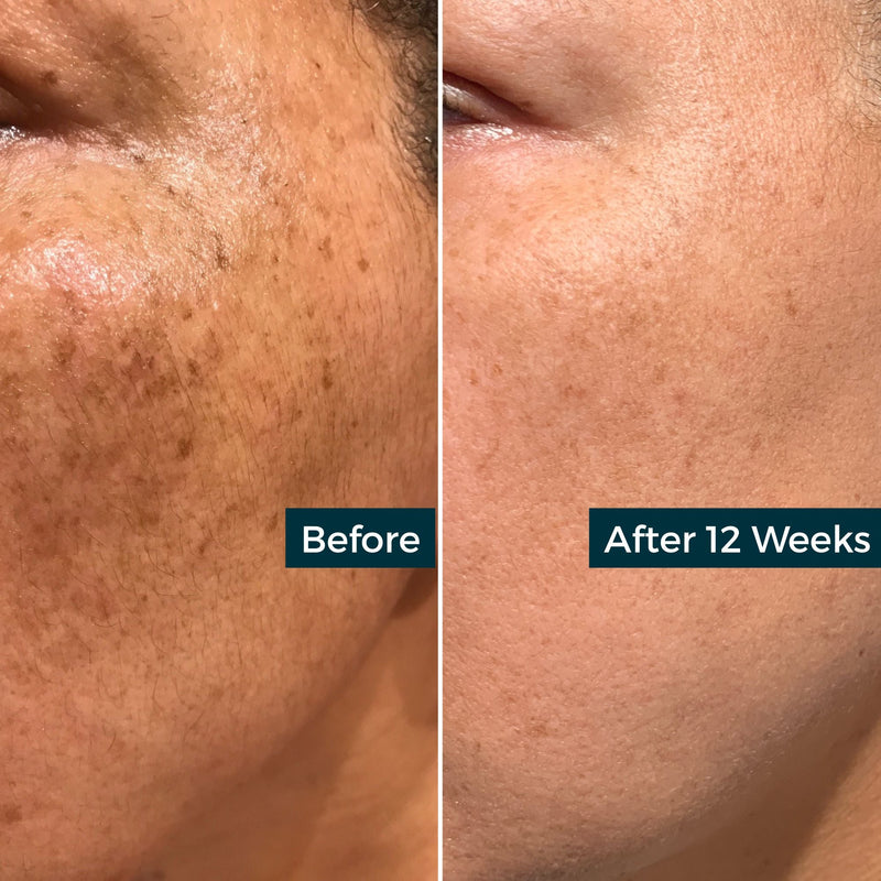 AbsoluteJOI® Skincare Retinol Plus Vitamin C Skin Refining Night Oil Face Oil