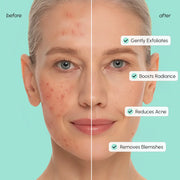 Maree Azelaic Acid Soothing Pads
