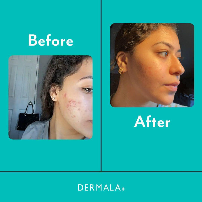 DERMALA SUPPLEMEANT to Be® - DIM Skin Mix