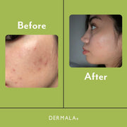 DERMALA SCANTILY Pad®