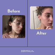 DERMALA SUPPLEMEANT to Be® Pre+Probiotic+Vitamin Skin Mix