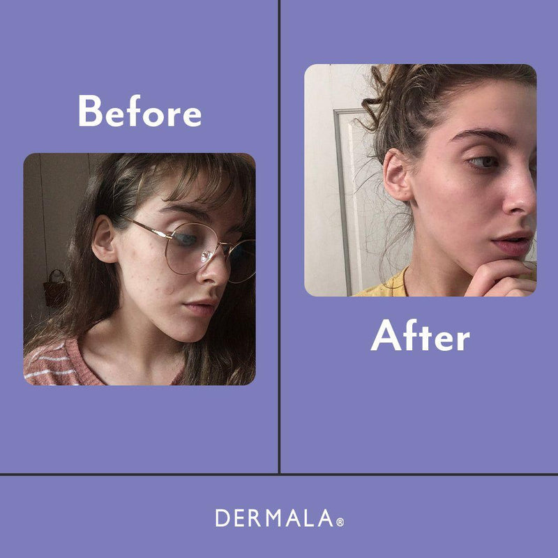 DERMALA SUPPLEMEANT to Be® Pre+Probiotic+Vitamin Skin Mix